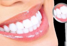 THAN HOẠT TÍNH TRẮNG RĂNG – CÓ THẬT SỰ HIỆU QUẢ ?