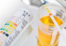 Glucose Niệu Là Gì ? Chúng Thể Hiện Điều Gì ? Glucose Niệu Là Gì